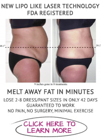 Weight Loss O'Fallon MO Laser Offer